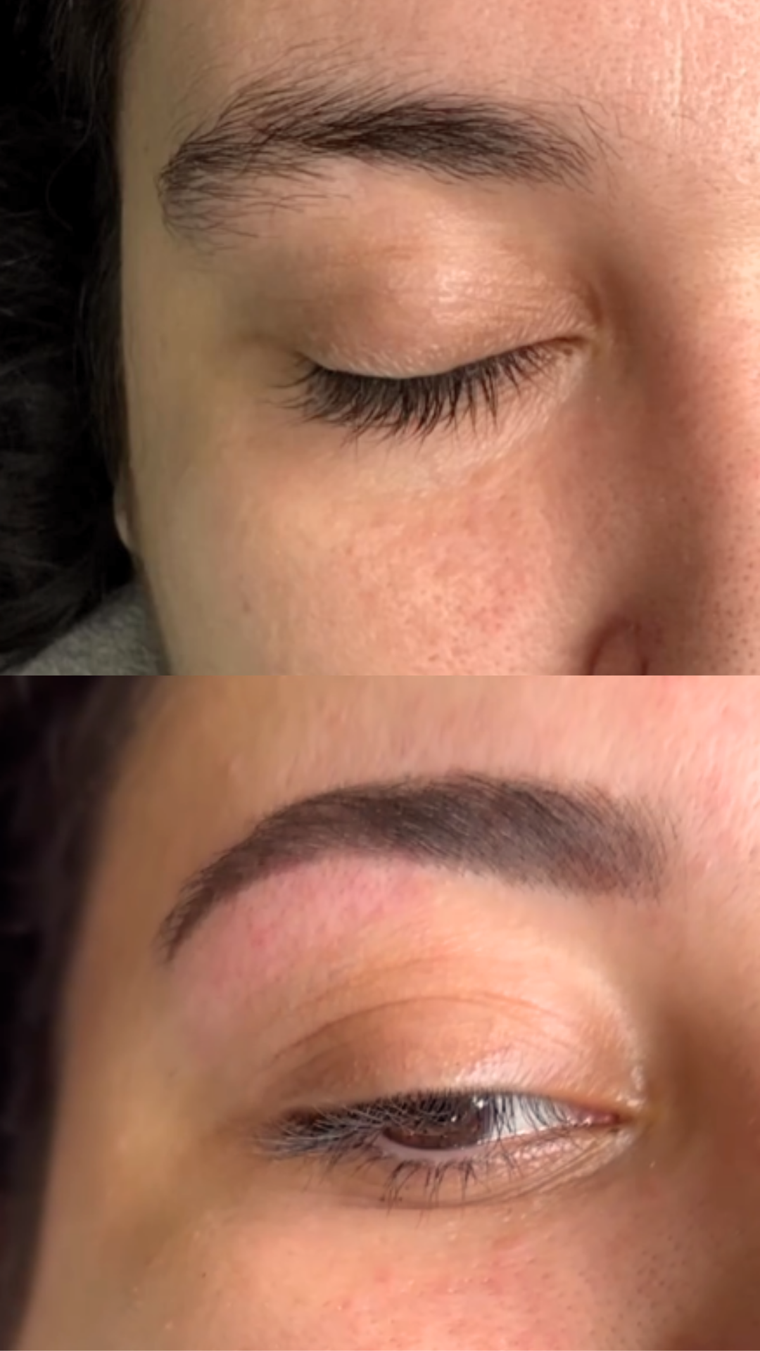 Before and After Result 3